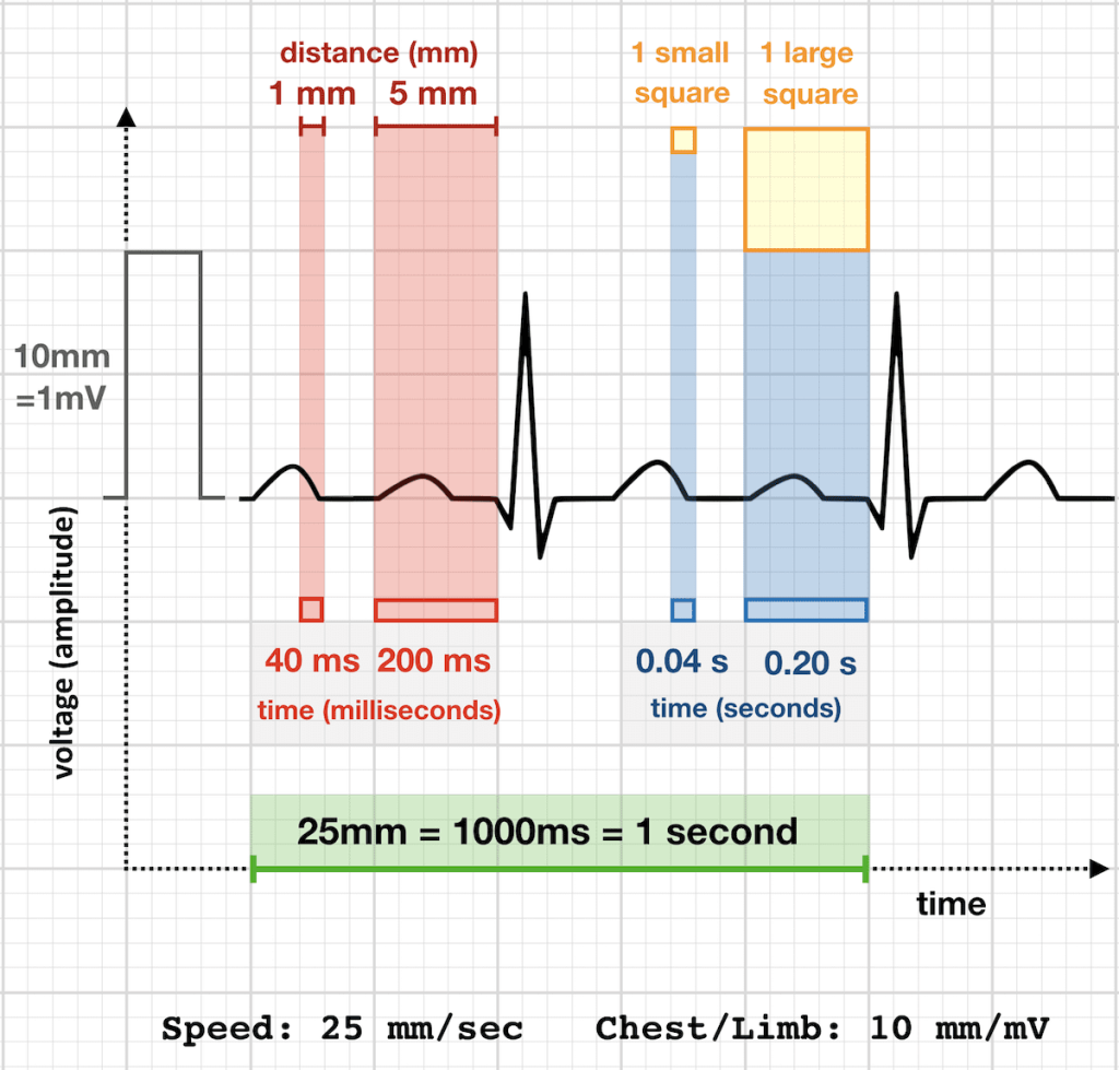how ecg machine works demonstration using graph